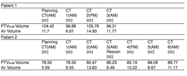 Breast Cancer CT Scan Chart